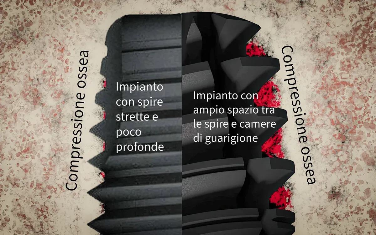 50Ncm e Più: Benefici e Rischi del Torque Alto