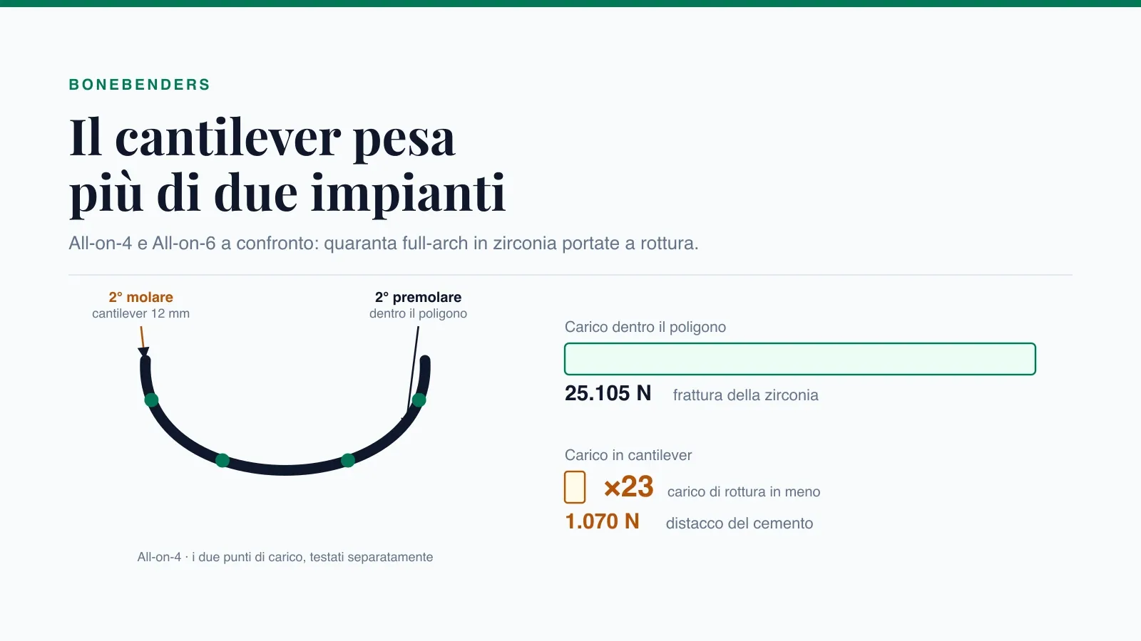 Arcata full-arch su quattro impianti con i due punti di carico e confronto dei carichi di rottura: 25.105 N dentro il poligono implantare contro 1.070 N in cantilever