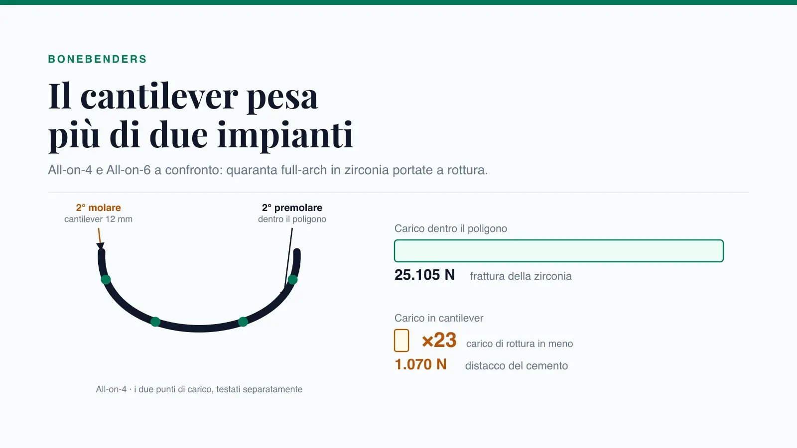 Arcata full-arch su quattro impianti con i due punti di carico e confronto dei carichi di rottura: 25.105 N dentro il poligono implantare contro 1.070 N in cantilever