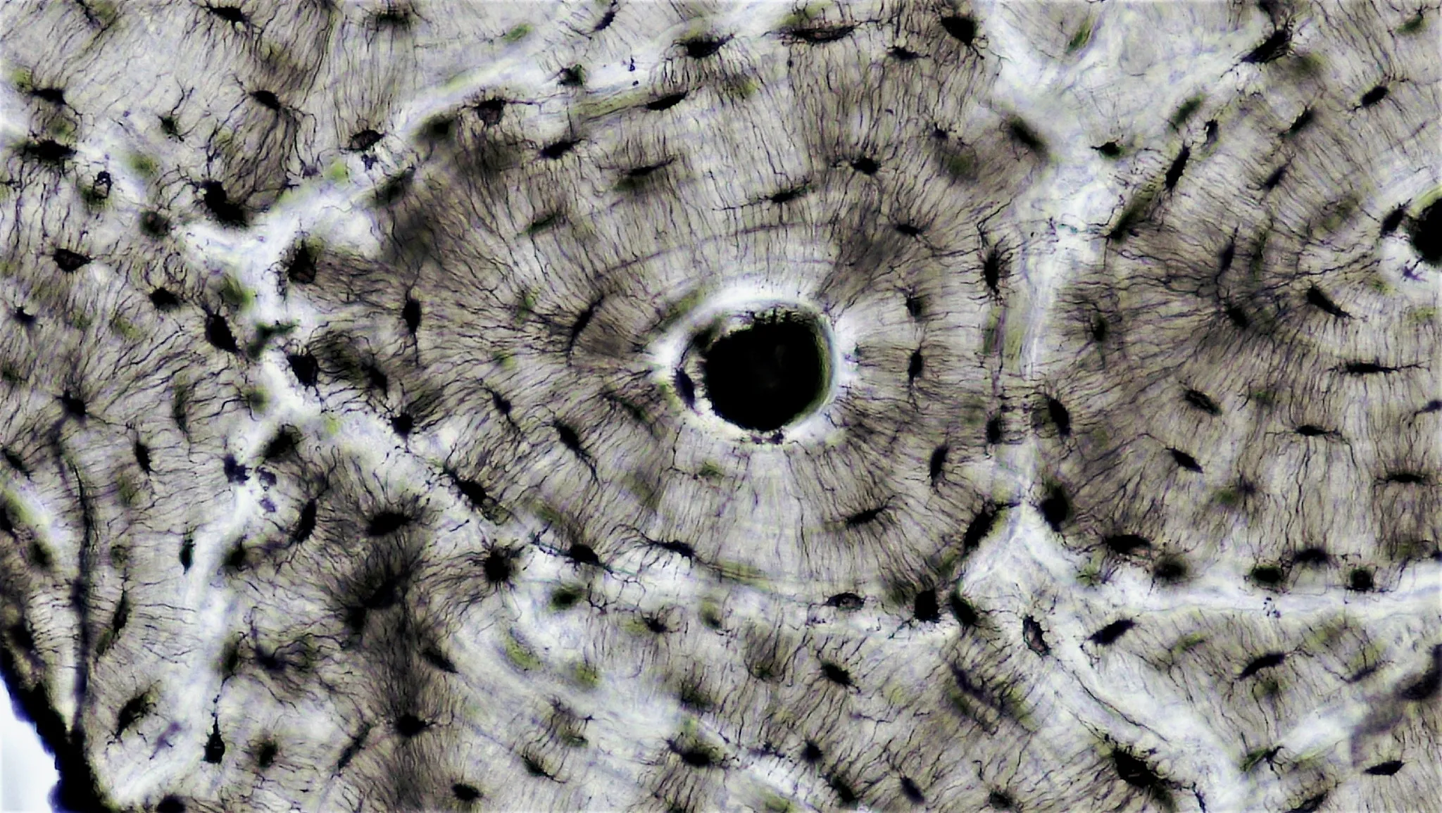 Sezione istologica dell'osso corticale — canale di Havers, lamelle concentriche e osteociti