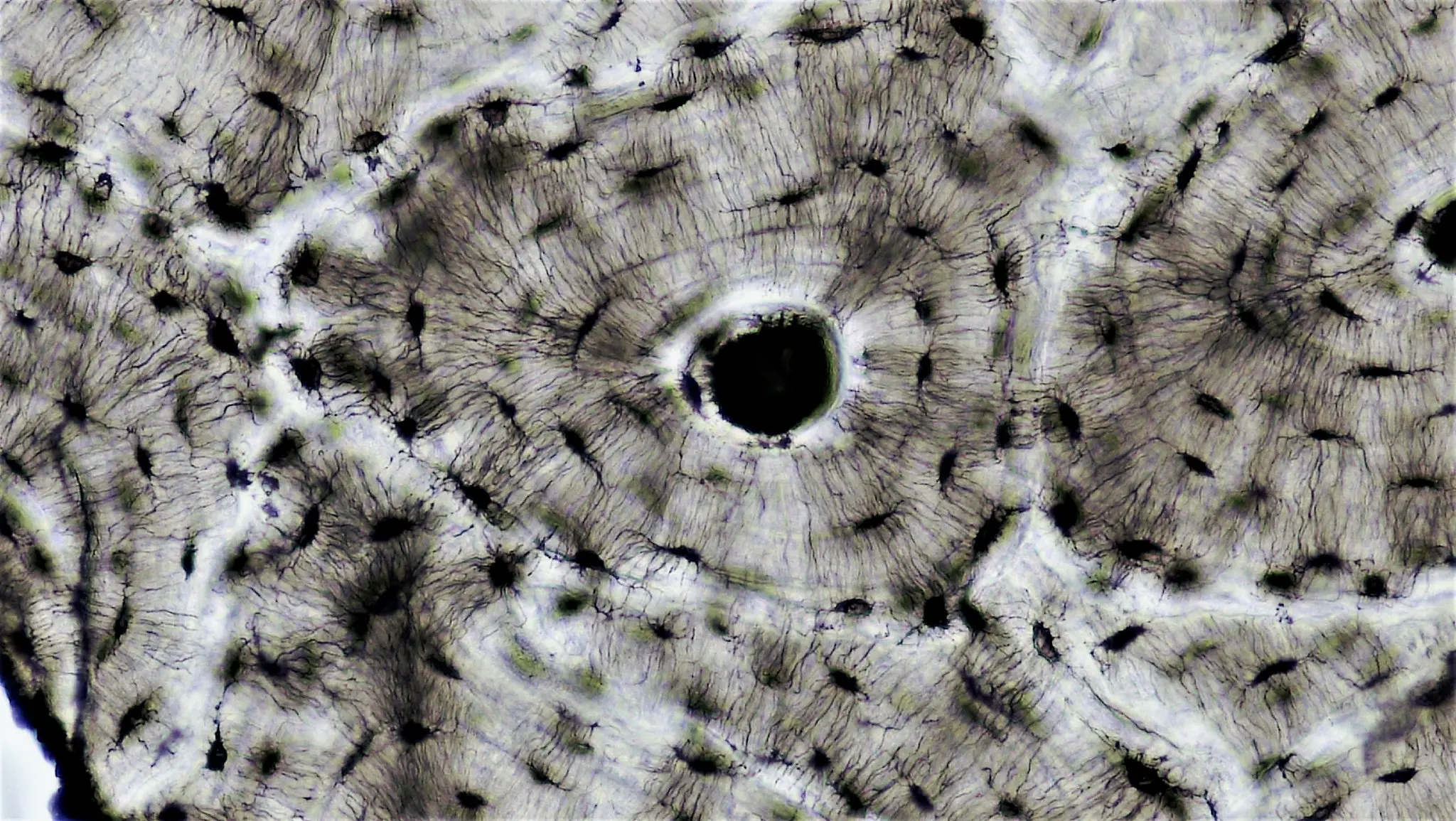 Sezione istologica dell'osso corticale — canale di Havers, lamelle concentriche e osteociti