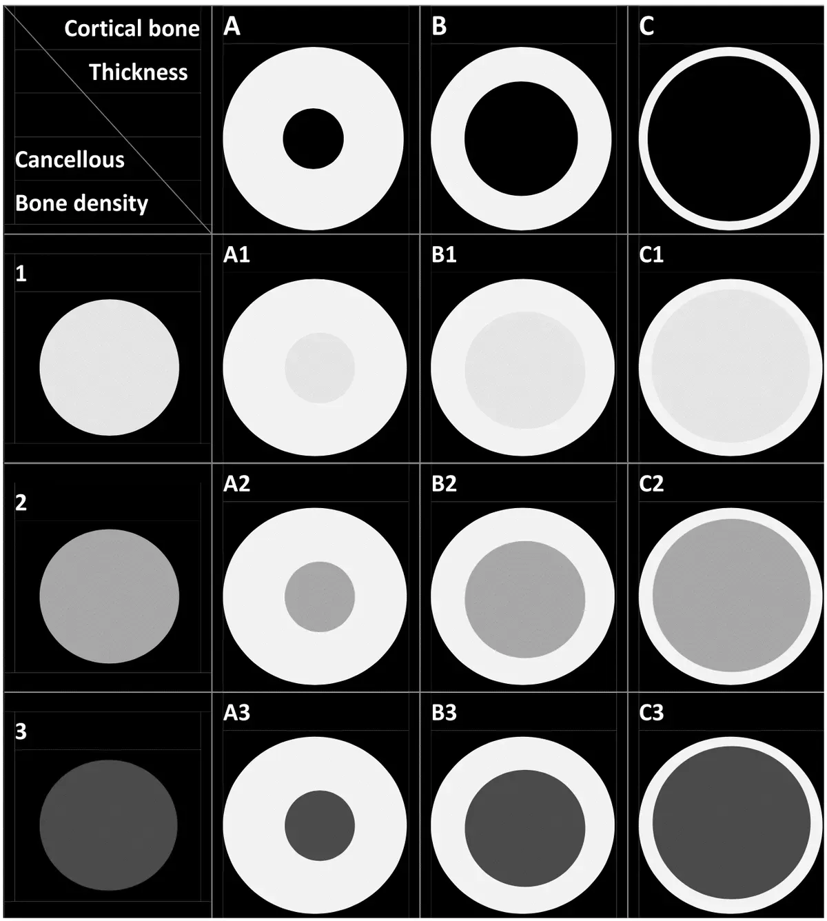 Classificazione Osso Alveolare Wang A1-C3: Oltre Misch D1-D4