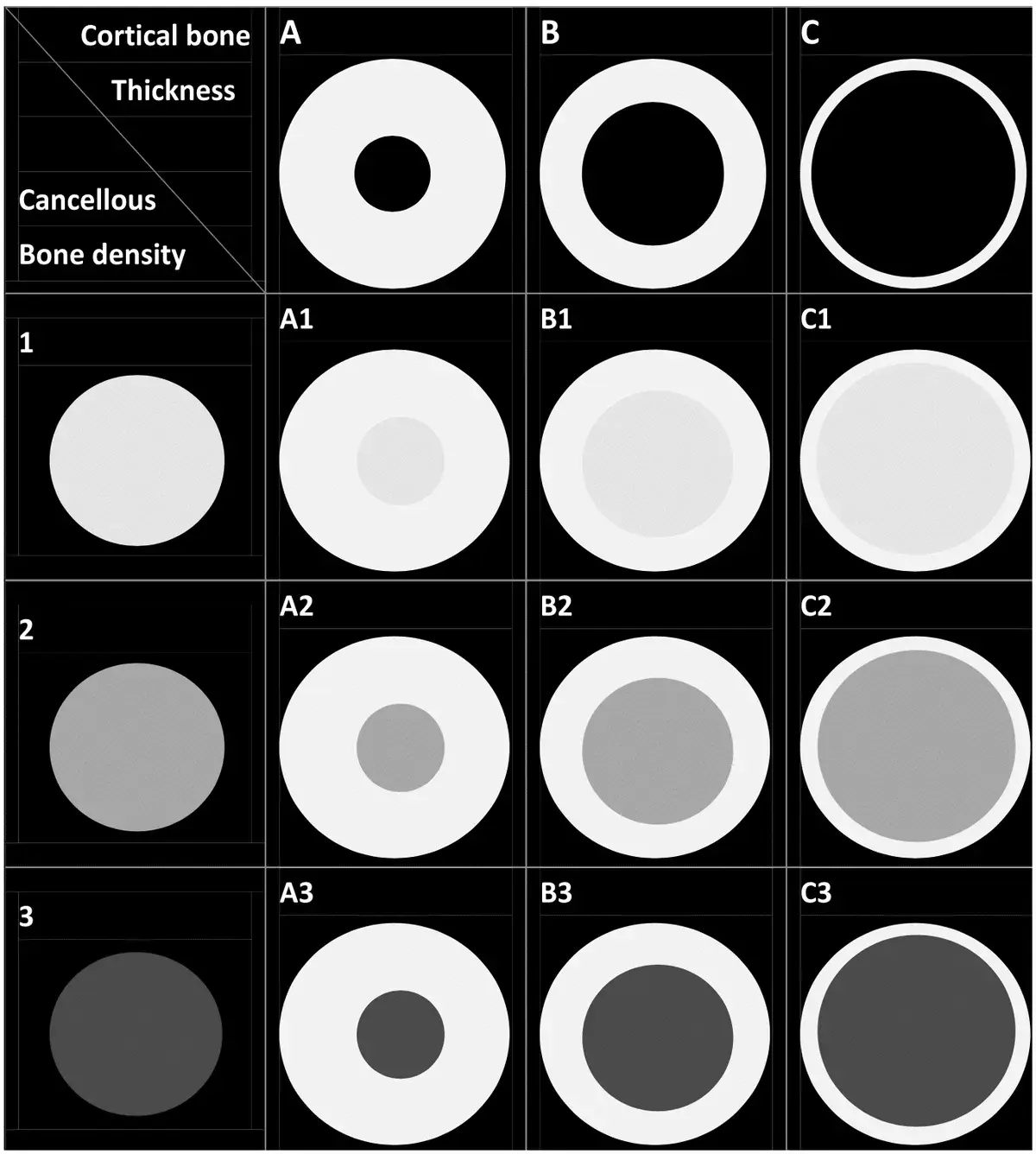 Classificazione Osso Alveolare Wang A1-C3: Oltre Misch D1-D4