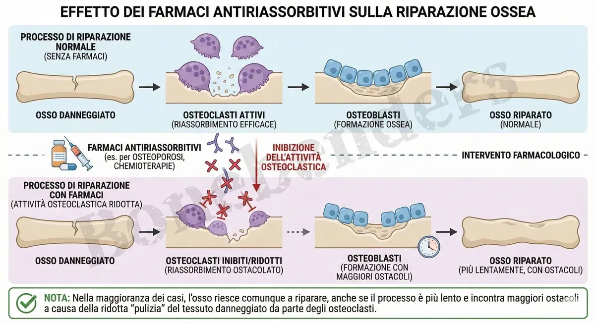 Bifosfonati, Prolia e Impianti Dentali: Consensus 2025