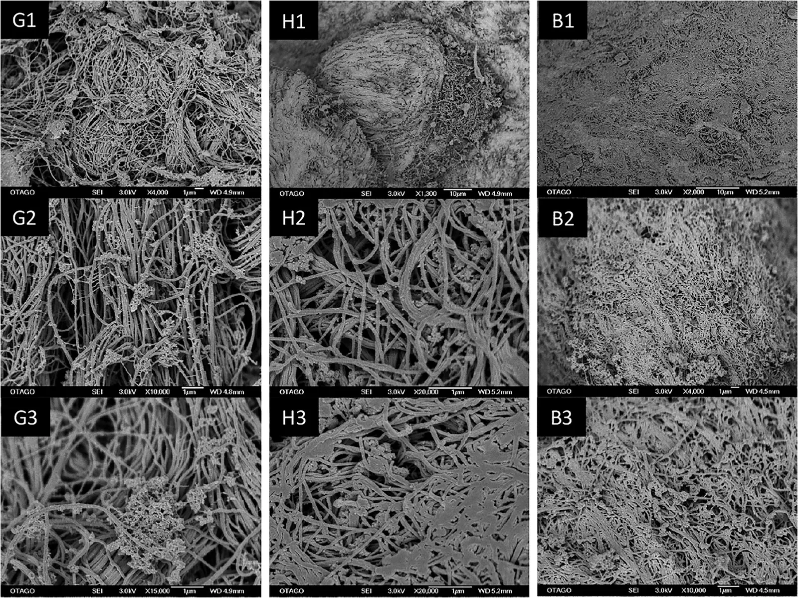 Microscopia elettronica a scansione del collagene nella lamina propria di gengiva (G1-G3), palato duro (H1-H3) e mucosa buccale (B1-B3) a ingrandimenti da ×1.300 a ×20.000. Si osserva il reticolo tridimensionale di fibre collagene, con fasci più spessi e densi nella gengiva cheratinizzata rispetto alla mucosa buccale. Da Choi JJE et al., Clin Exp Dent Res, 2020. CC BY 4.0.
