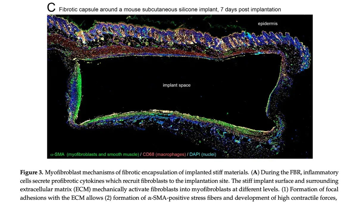 Miofibroblasti: Cosa Sono e Perché Decidono il Destino dell'Impianto