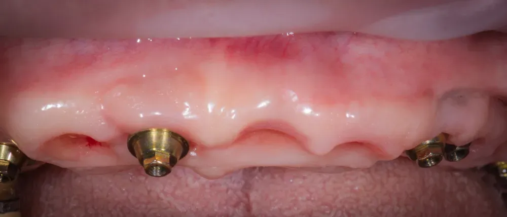 
Visione frontale dell