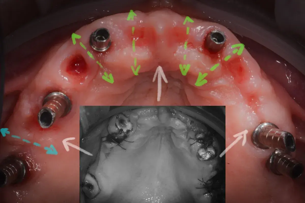 L’espansione è magica.  Rigenera secondo natura.
