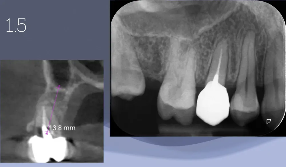 Illustrazione radiografica dell