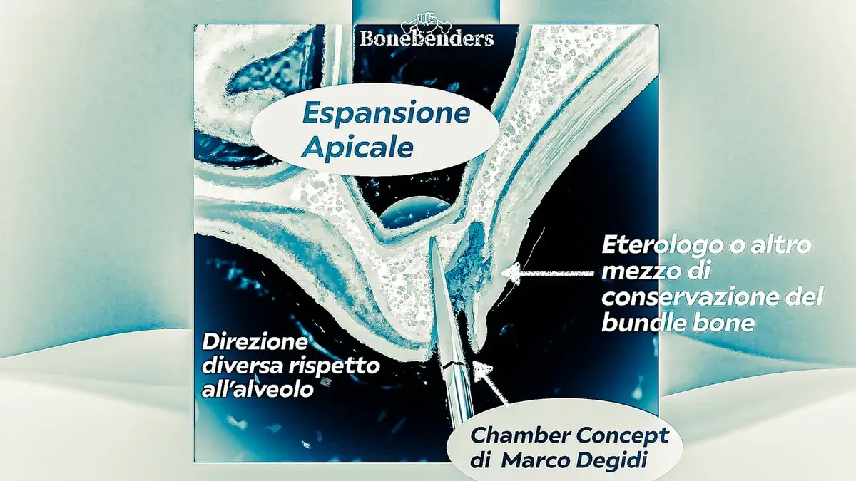 L’Illusione della Semplicità: Post-Estrattivi Monoradicolati