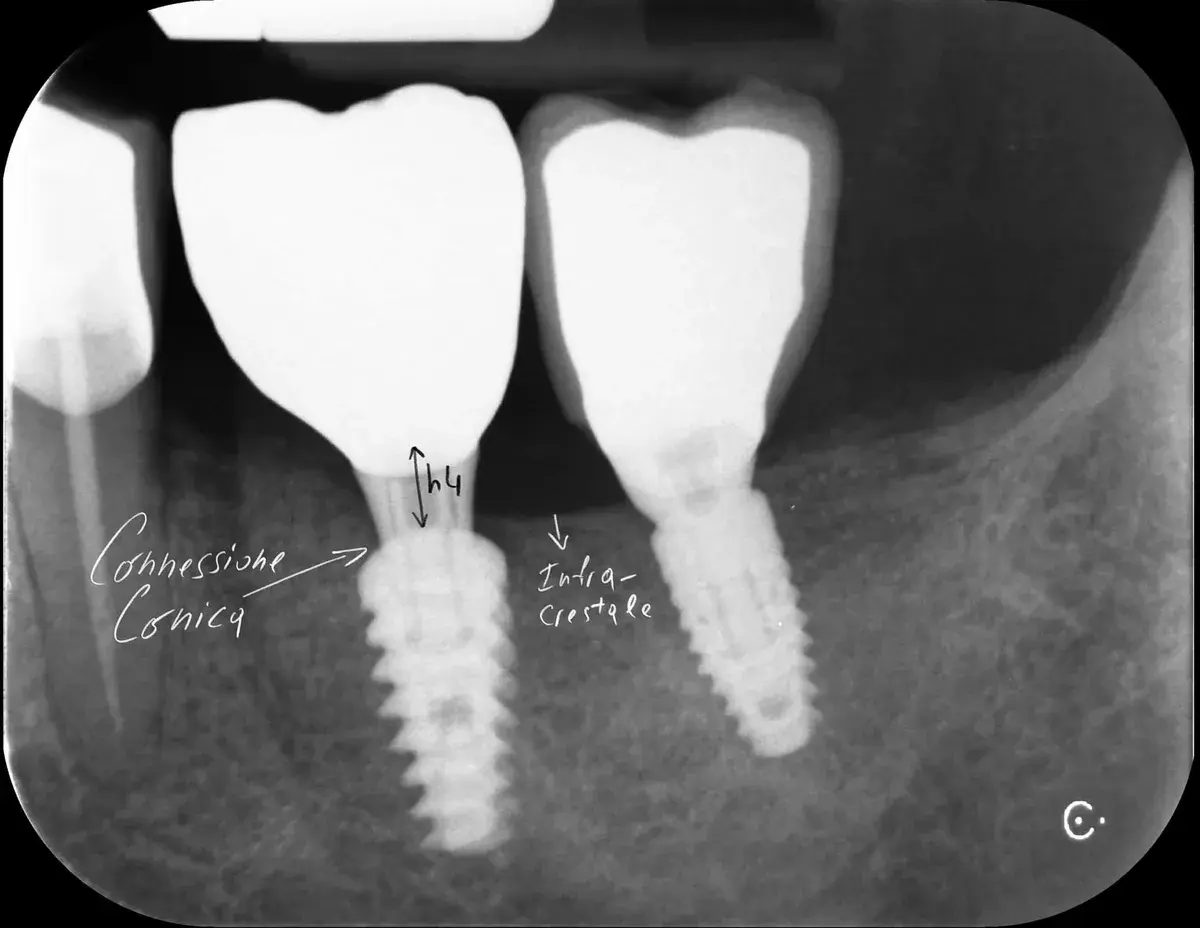 Orrori Evitabili: Impianti, Connessioni, e Componenti
