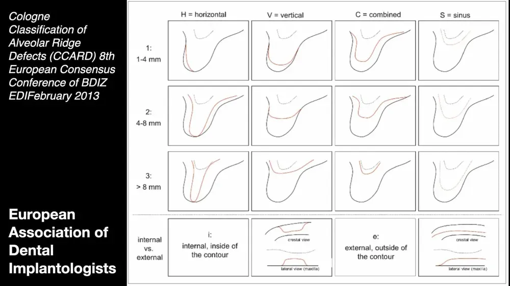 Classificazione di difetti dell