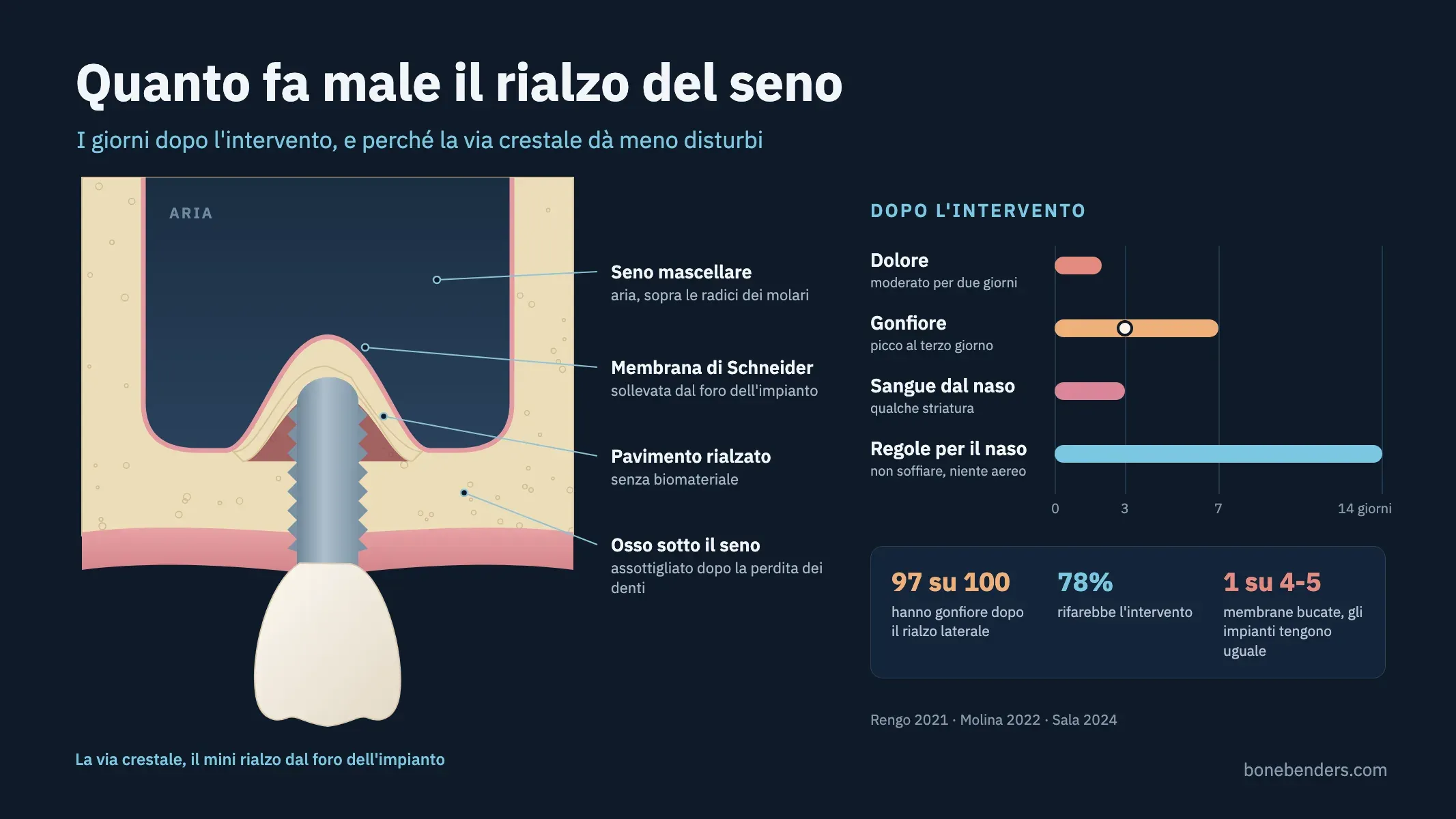 Sezione del mascellare con il mini rialzo dal foro dell'impianto, la membrana sollevata senza biomateriale, e i giorni del decorso: dolore, gonfiore, sangue dal naso e regole per il naso