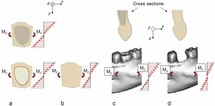 Immagine che mostra sezioni trasversali e schemi di carico funzionale per diverse forze applicate alla mandibola.