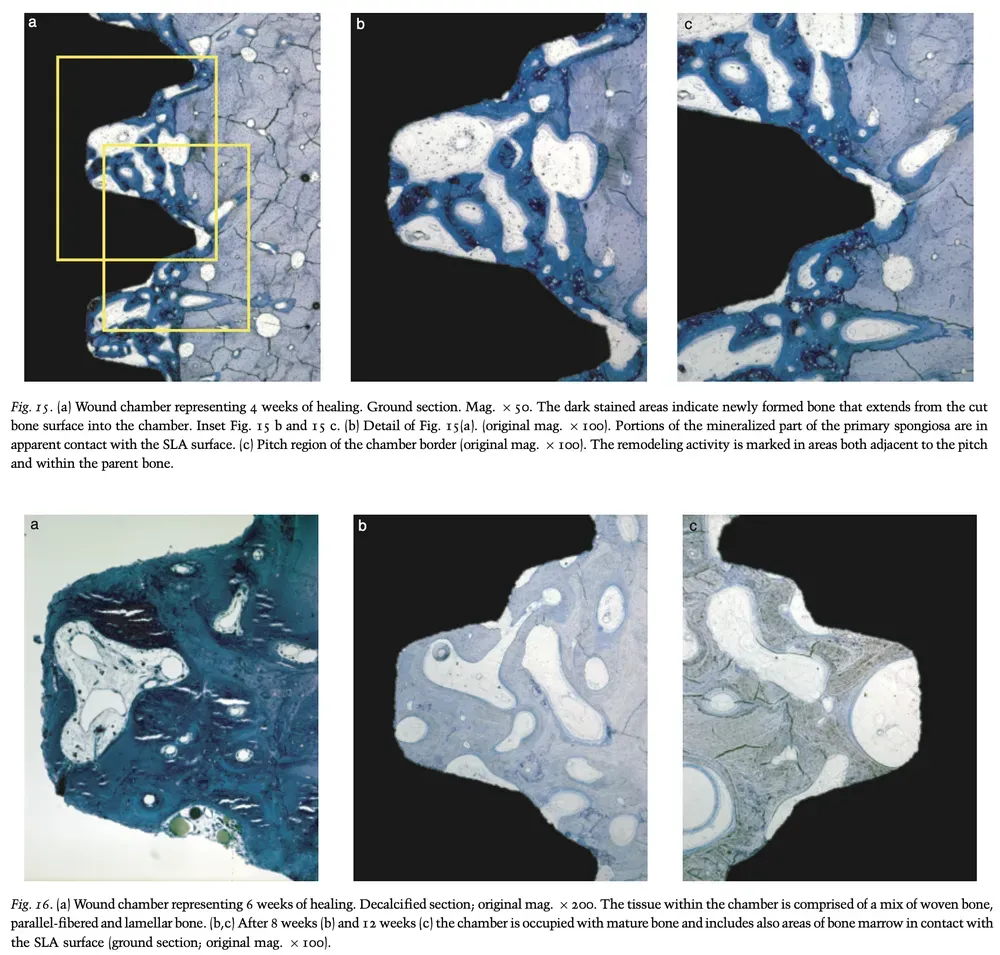 Immagine istologica che mostra il processo di guarigione ossea in un campione di impianto dopo 4 e 6 settimane, evidenziando aree di osso nuovo formato vicino alla superficie dell