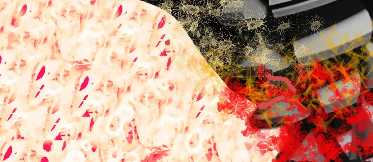 Ti hanno mentito sulla stabilità primaria