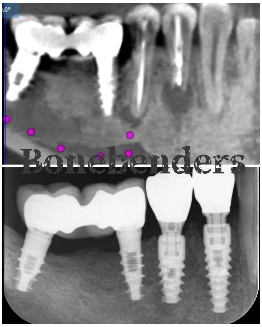 Un impianto immediato è (quasi) sempre la soluzione migliore